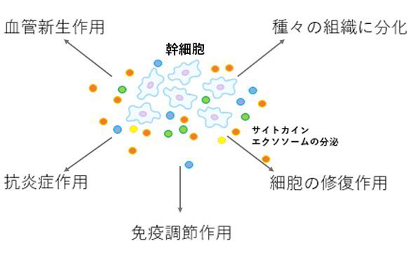 間葉系幹細胞移植治療とは
