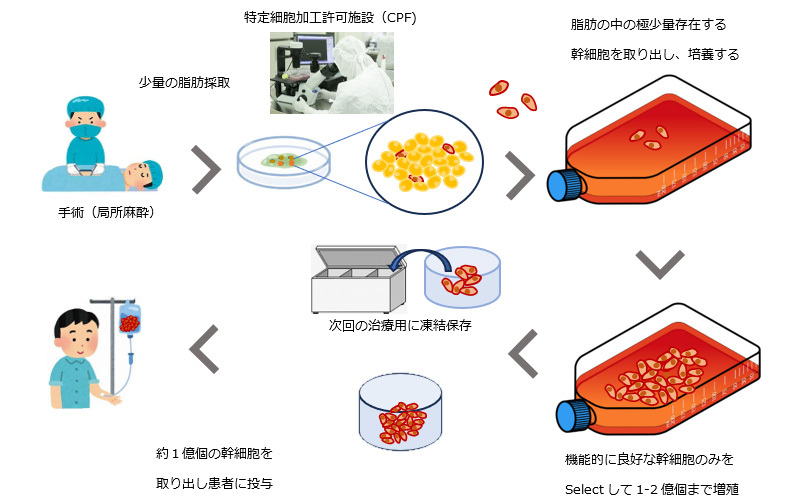 間葉系幹細胞の採取方法